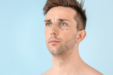 Wall Mural - Young man with marks on his face against color background. Concept of plastic surgery