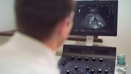 Closeup screen of ultrasound pregnancy diagnosis