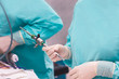 Surgical laparoscopic camera, minimally invasive. Closing operation in operating room endoscopy. during surgery, the surgeon transfers the instrument to endoscopy, trocar