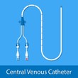 central venous catheter CVC PICC line peripherally inserted access large vein medication fluid blood IV parenteral chemotherapy port a cath drug dialysis pressure medicine cancer kidney test implanted