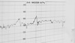 © naiauss - ecg graph, electrocardiogram ekg on paper