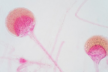 Rhizopus bread mold under the microscope.