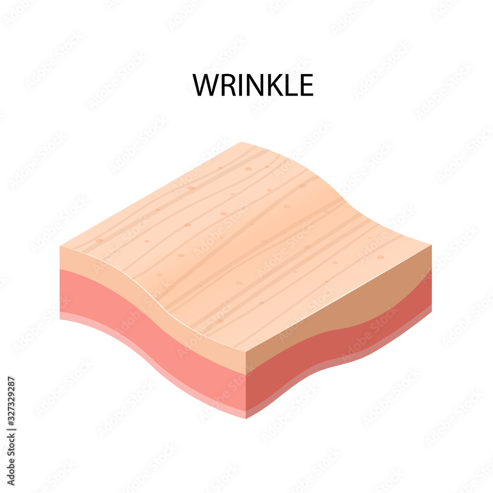 wrinkle formation cross-section of human skin layers structure skincare ...