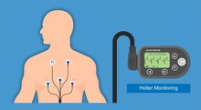 Holter Monitoring System Tracking Cardio Problem Failure Sick Irregular Disorders Transducer Therapy Cardioversion Heartbeat Non Invasive Diagnosis Treat