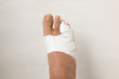 Close up of a Man’s bandaged up broken toe 