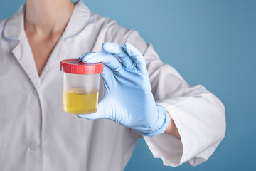 Doctor in white uniform and blue medical gloves holding a container for urine analysis. Urine testing for diseases and drugs in clinic