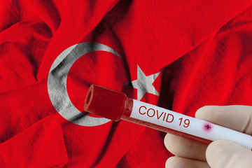 COVID-19 chinese infection Novel Corona virus of Turkey infection blood test in Laboratory