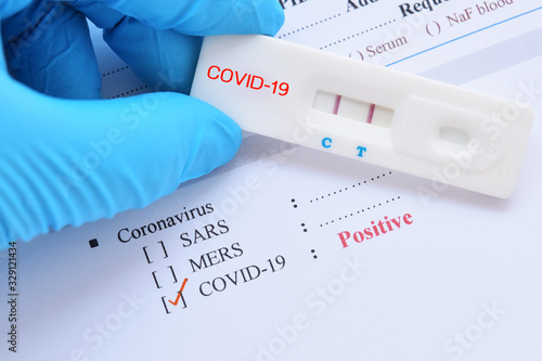 Fotografía Positive test result by using rapid test device for COVID-19, novel coronavirus