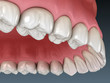 © Alex Mit - Maxillary human gum and teeth. Medically accurate tooth 3D illustration