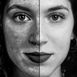 Monochromatic collage comparing close up with and without applying ultraviolet light filter to detect skin damages. Young caucasian woman with piercing in nose. Medicine and healthcare concept...