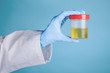 doctor in a white medical gown and blue gloves on a blue background holds in his hand a jar for medical tests with a red lid with yellow urine
