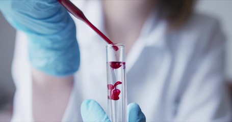 Wall Mural - Scientist with pipette analyzes red colored liquid to extract the DNA and molecules in the test tubes.