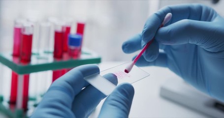 Wall Mural - Close- up of scientist studying sample under microscope in the laboratory.