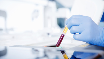 Wall Mural - bioengineer holds test tubes of blood samples for dna analysis and presence of virus in cytoplasm, b