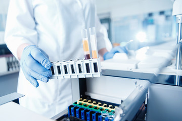 Wall Mural - medical equipment bioengineer installs blood test on tubes in automatic tester