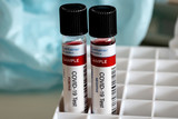 Fototapeta Paryż - Testing for presence of coronavirus. Tube containing a blood sample for COVID-19.