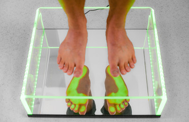 Health care foot procedure analysis by step green scanning.