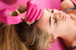 © lisovoy - Needle mesotherapy. Cosmetic been injected in woman's head. Thrust to strengthen the hair and their growth