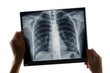 Examination of a chest x-ray