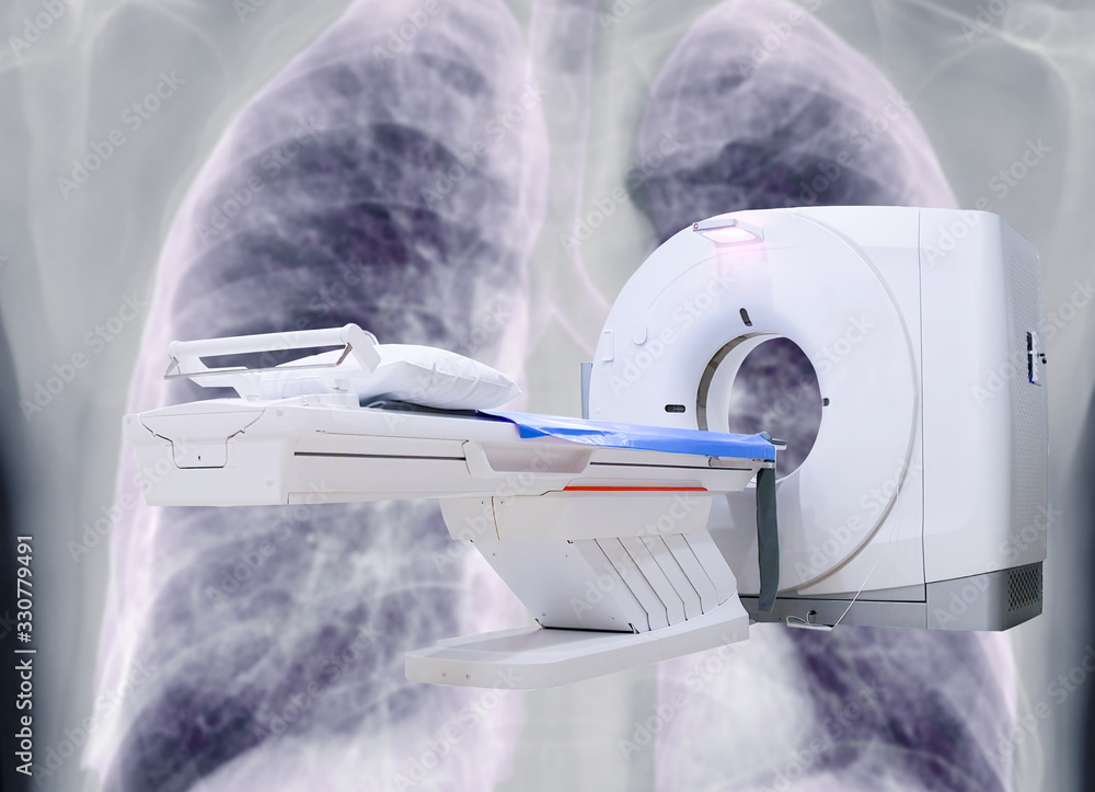 multi detector CT Scanner ( Computed Tomography ) on chest x-ray ...