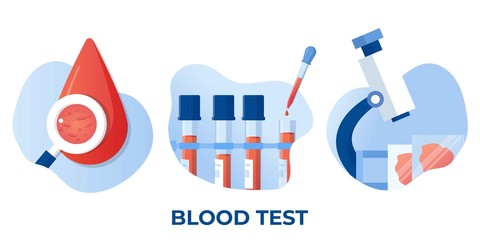 Medical blood test flat concept. Chemical laboratory analysis, medical office or laboratory. Patient blood in test tubes, medical blood test, blood samples. Chemical laboratory analysis