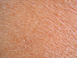 dry skin or ichthyosis texture detail in women using for moisturizer lotion, cream or beauty product concept, motion blur and macro shot photo.