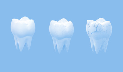 Wall Mural - Broken molars tooth and whole tooth isolated on blue background