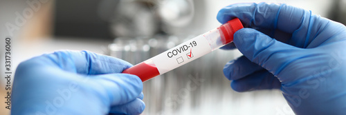 Fotografía Male chemist hand hold vial with red blood liquid closeup background