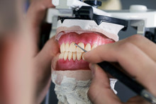 Dental Technician Creates Removable Dental Prostheses With Pink Gum