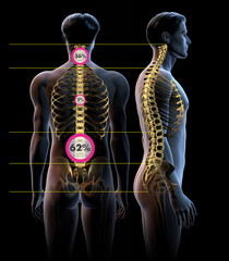 Wall Mural - Backache pain, spine in back view and side view, 3D medically illustration