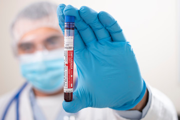 Doctor holding test tube blood sample