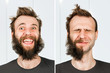 happy guy with half beard and without hair loss. Man before and after shave or transplant. haircut set transformation.