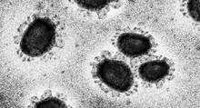 Zoonose - Covid-19, Coronavirus Unter Dem Mikroskop, Wissenschaftliche Illustration