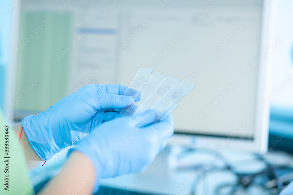 Microscopic testing of patient biopsy samples. Medical hospital test ...