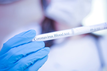 The nurse holds samples of coronevirus assays.