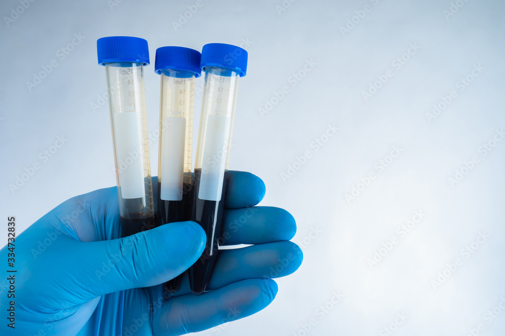 Human holds several test tubes with blood. Hand with plastic test tubes ...