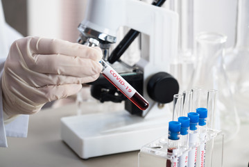 Nurse holding test tube with blood for nCoV-2019 analyzing, coronavirus test concept in laboratory