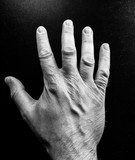 Fototapeta Psy - Zniszczona skóra na ludzkiej dłoni.