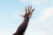 © Santi Nunez/Stocksy - Man's hand with vitiligo against cloudy sky