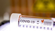 The Covid-19 positive mark for coronavirus test kit
