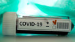 The small test kit with positive mark for coronavirus