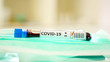 A blue cap test tube with a positive mark for coronavirus