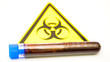 The yellow hazard sign with the blood sample kit 2