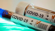 Two sample kits with coronavirus positive mark