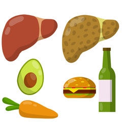 Healthy and diseased liver. Causes of illness the internal organ. Greasy Burger, alcohol beer, carrots, avocado. Medical diagnosis. Funny cartoon flat illustration. Set of Diet and good nutrition