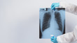 Lungs x-ray film in doctor hands wearing medical gloves and PPE suit which showing scan-film of uncommon respiratory syndrome or pneumonia disease or unhealthy that infected by Coronavirus or Covid-19