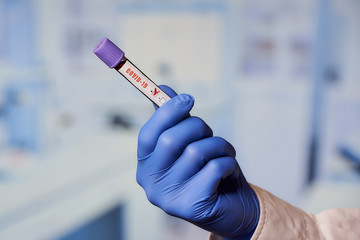 A hand of a lab assistant in a blue disposable medical glove holding a positive coronavirus (COVID-19) blood test in the laboratory.