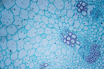 microscopic image of sunflower stem (cross-section)
