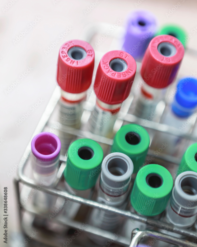 Blood collection tubes in a hospital lab Stock Photo | Adobe Stock