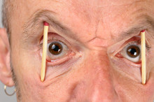 Close Up Of Man Keeping Eyes Wide Open With Match Sticks